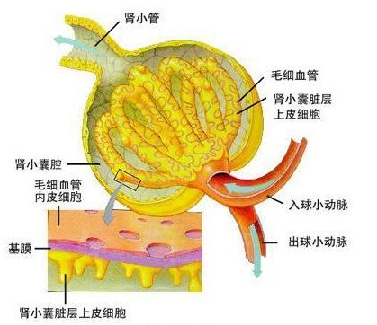 小儿肾病综合症