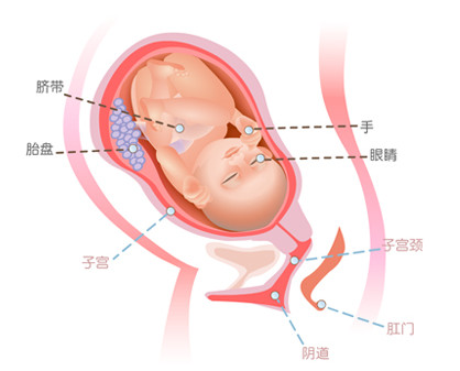 脐带绕颈